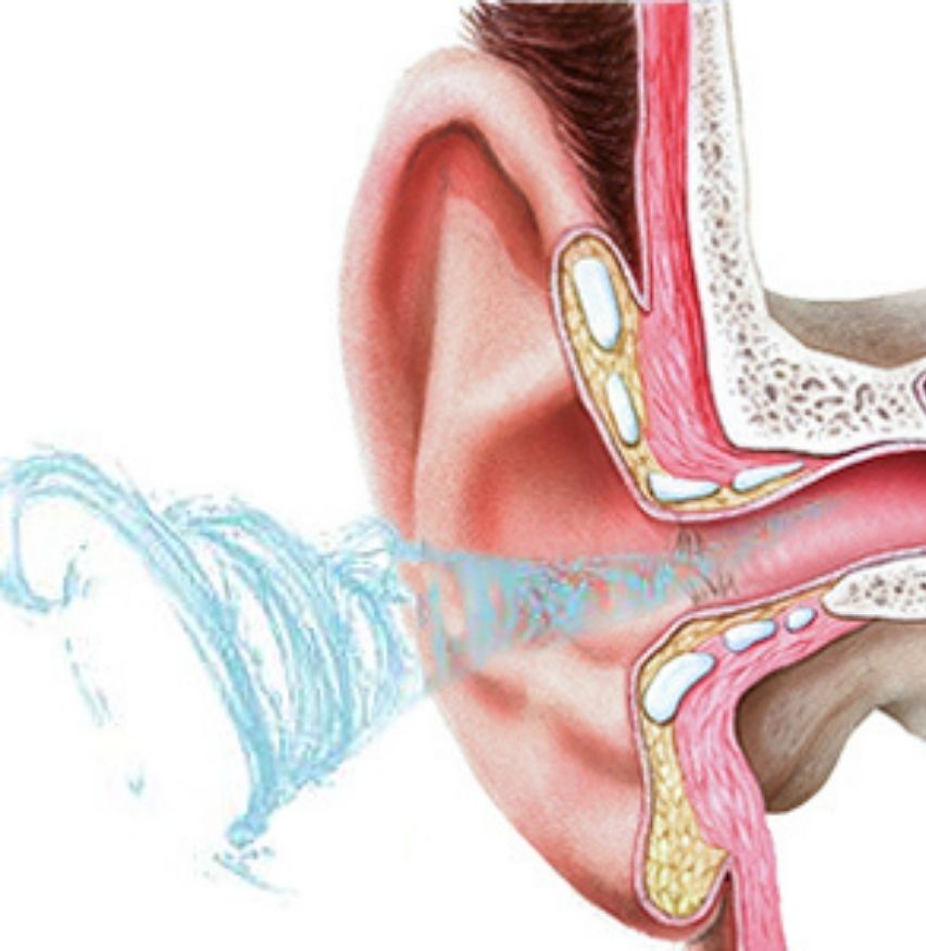 Ear Washer: image 6